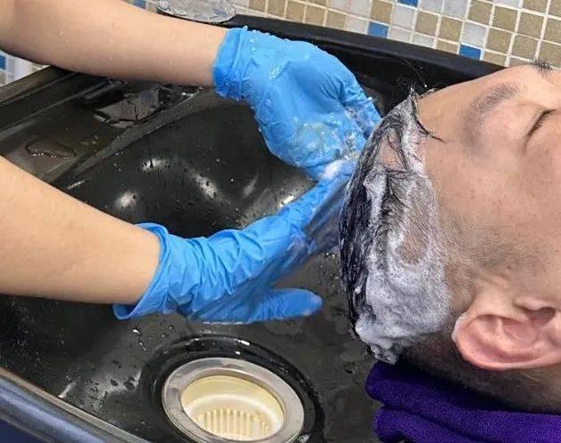 做了植发没效果？植发也有滞后性！深圳鹏程植发在线科普！