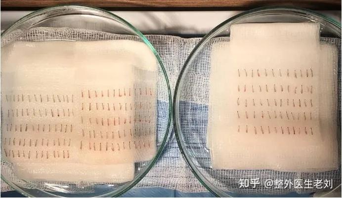 植发1元变上万元，植发真的靠谱吗？