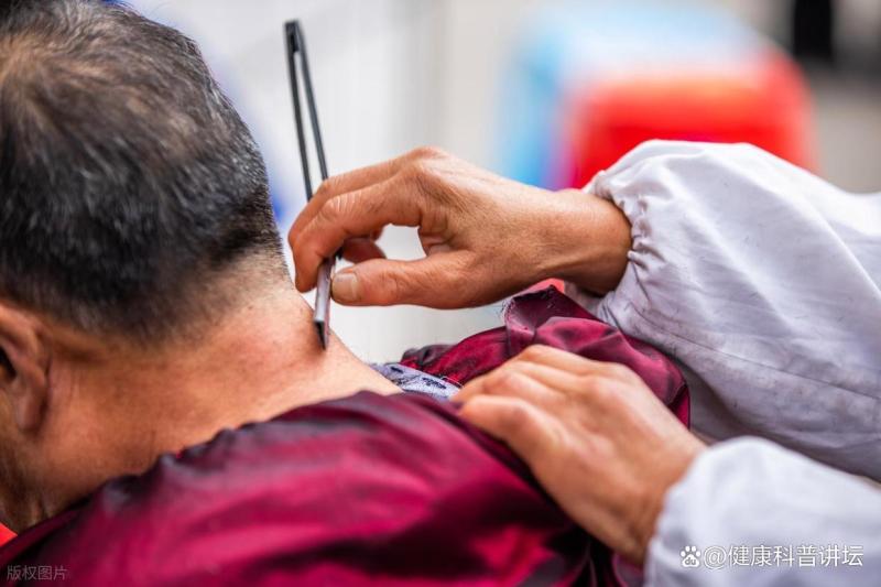 频繁掉发干脆剃光头养发？有人真这么干了，医生提醒细节